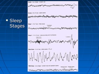  SleepSleep
StagesStages
 
