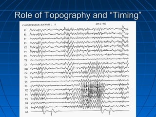 Role of Topography and “Timing”Role of Topography and “Timing”
 