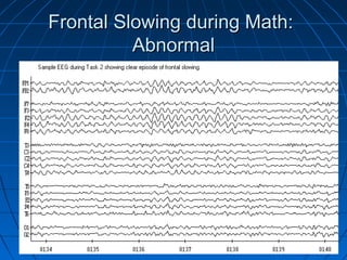 Frontal Slowing during Math:Frontal Slowing during Math:
AbnormalAbnormal
 