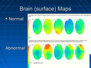 Brain (surface) MapsBrain (surface) Maps
 NormalNormal
AbnormalAbnormal
 