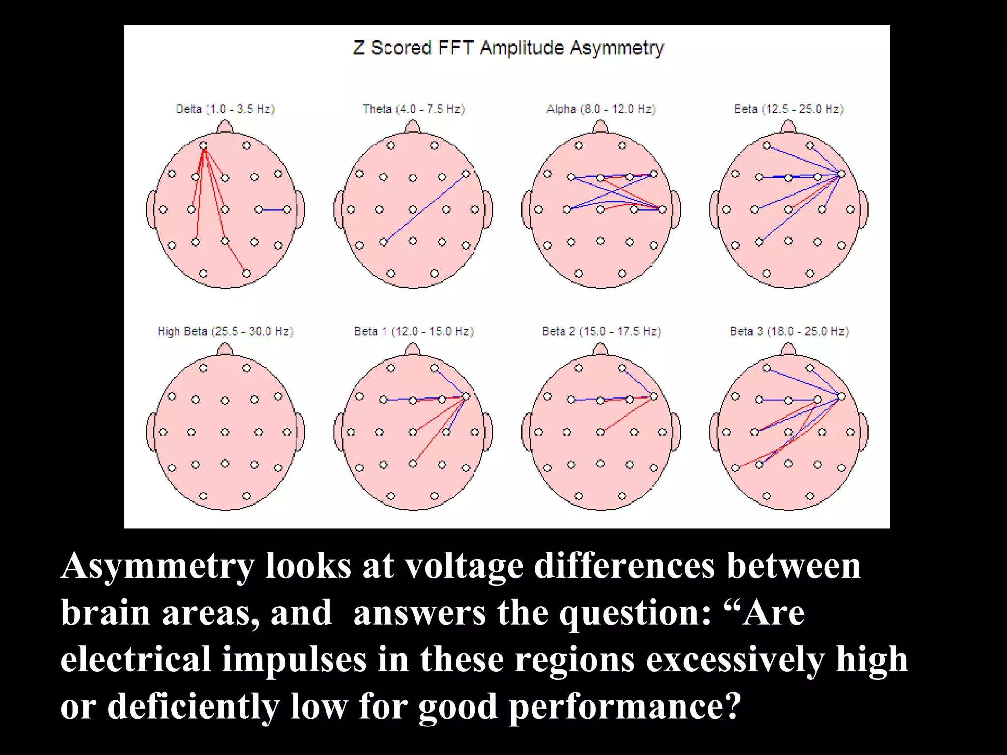 Asymmetry looks at voltage differences between  brain areas, and  answers the question: “Are  electrical impulses in these regions excessively high  or deficiently low for good performance? 