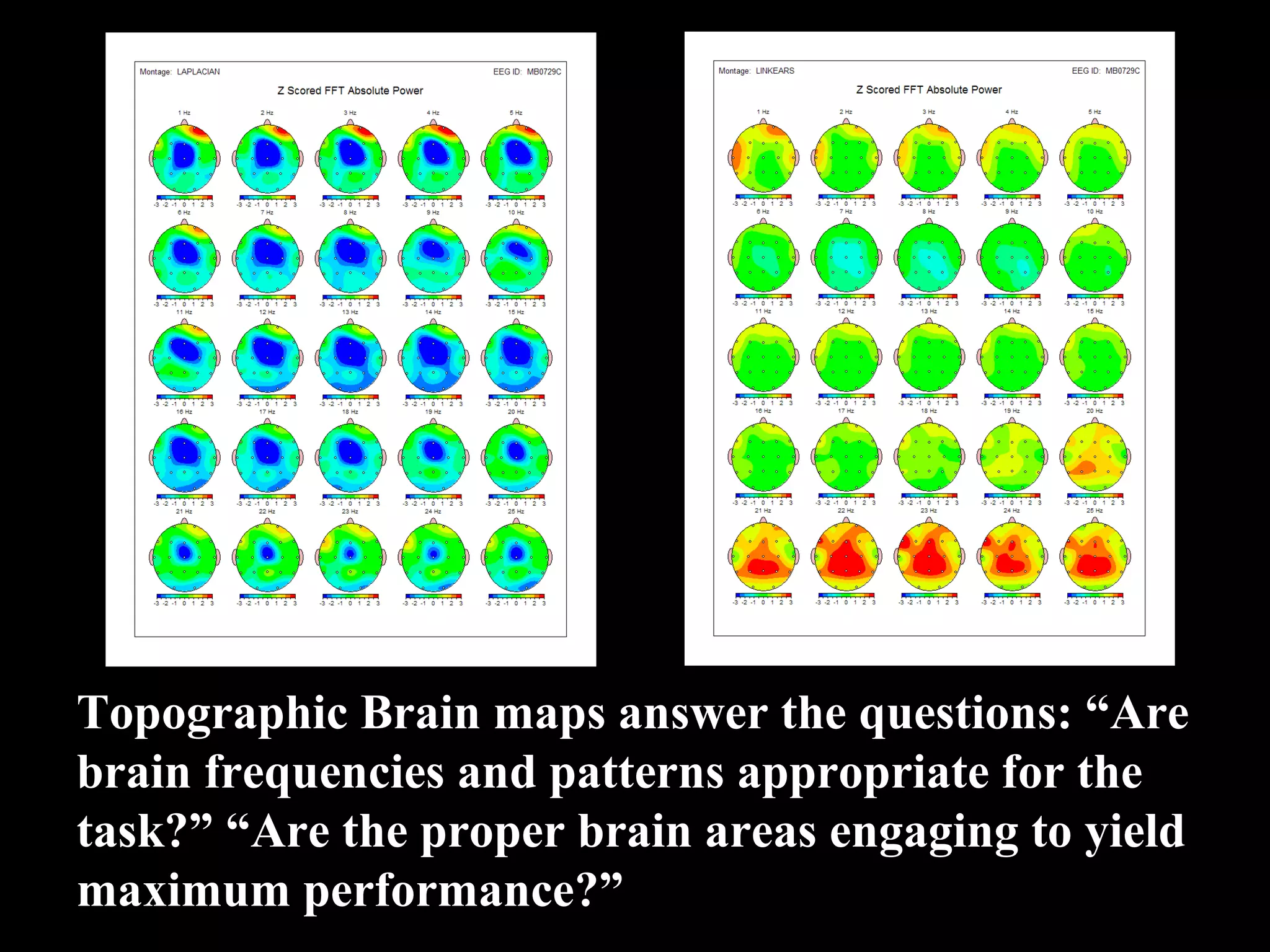 Topographic Brain maps answer the questions: “Are brain frequencies and patterns appropriate for the task?” “Are the proper brain areas engaging to yield maximum performance?” 