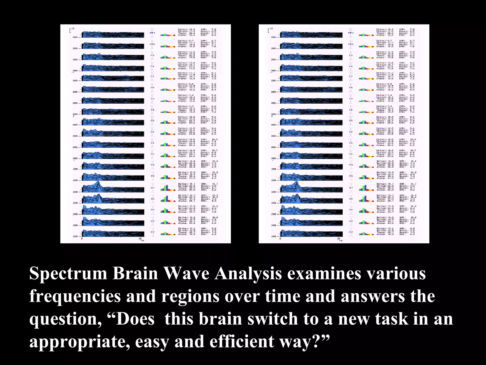 Spectrum Brain Wave Analysis examines various frequencies and regions over time and answers the question, “Does this brain switch to a new task in an appropriate, easy and efficient way?” 
