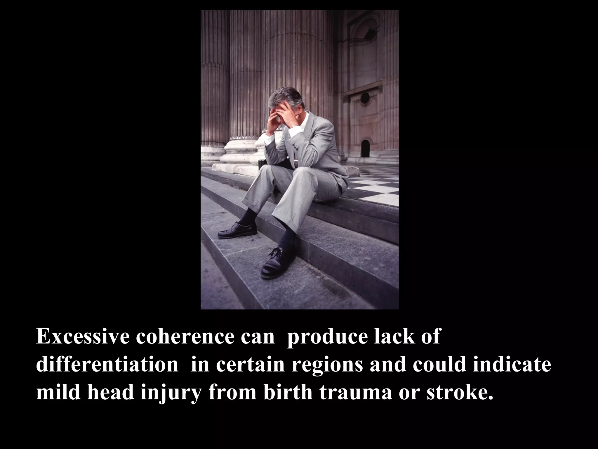 Excessive coherence can produce lack of differentiation in certain regions and could indicate mild head injury from birth trauma or stroke. 