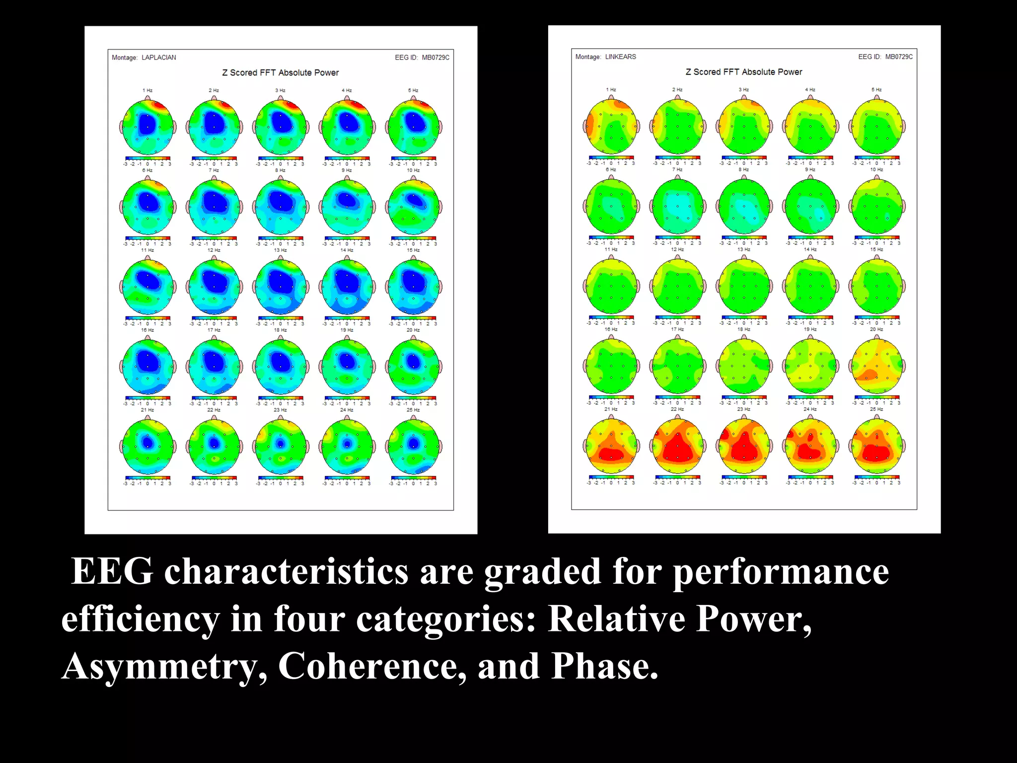 EEG characteristics are graded for performance efficiency in four categories: Relative Power, Asymmetry, Coherence, and Phase. 