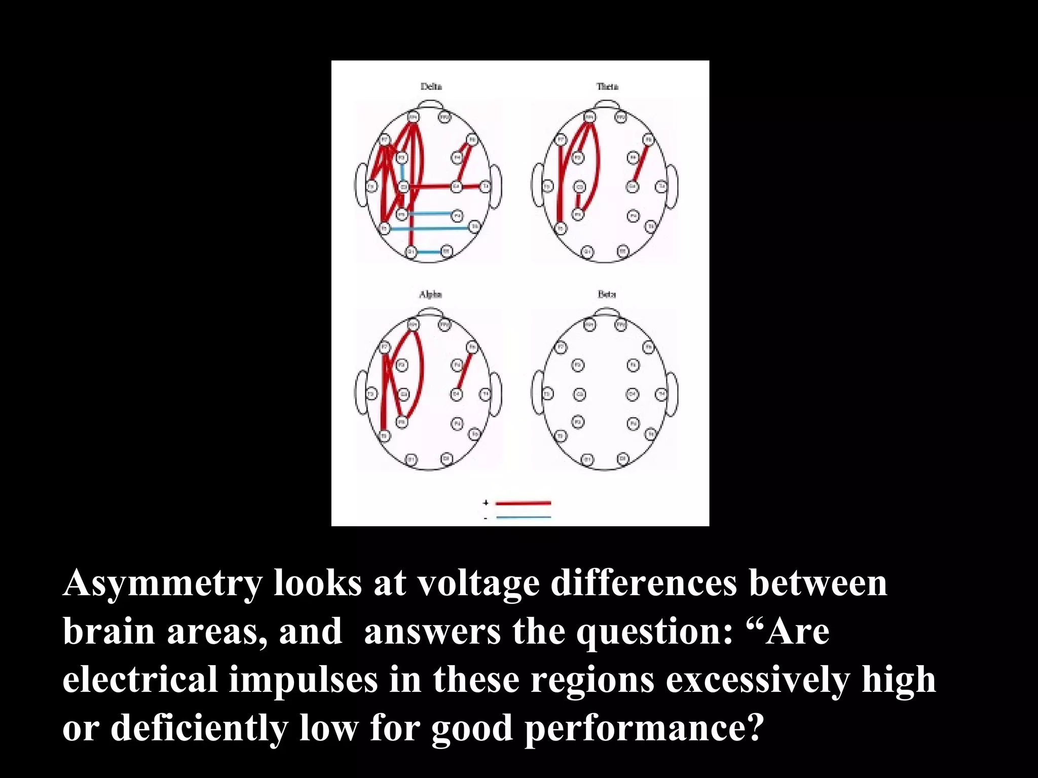 Asymmetry looks at voltage differences between brain areas, and answers the question: “Are electrical impulses in these regions excessively high or deficiently low for good performance? 
