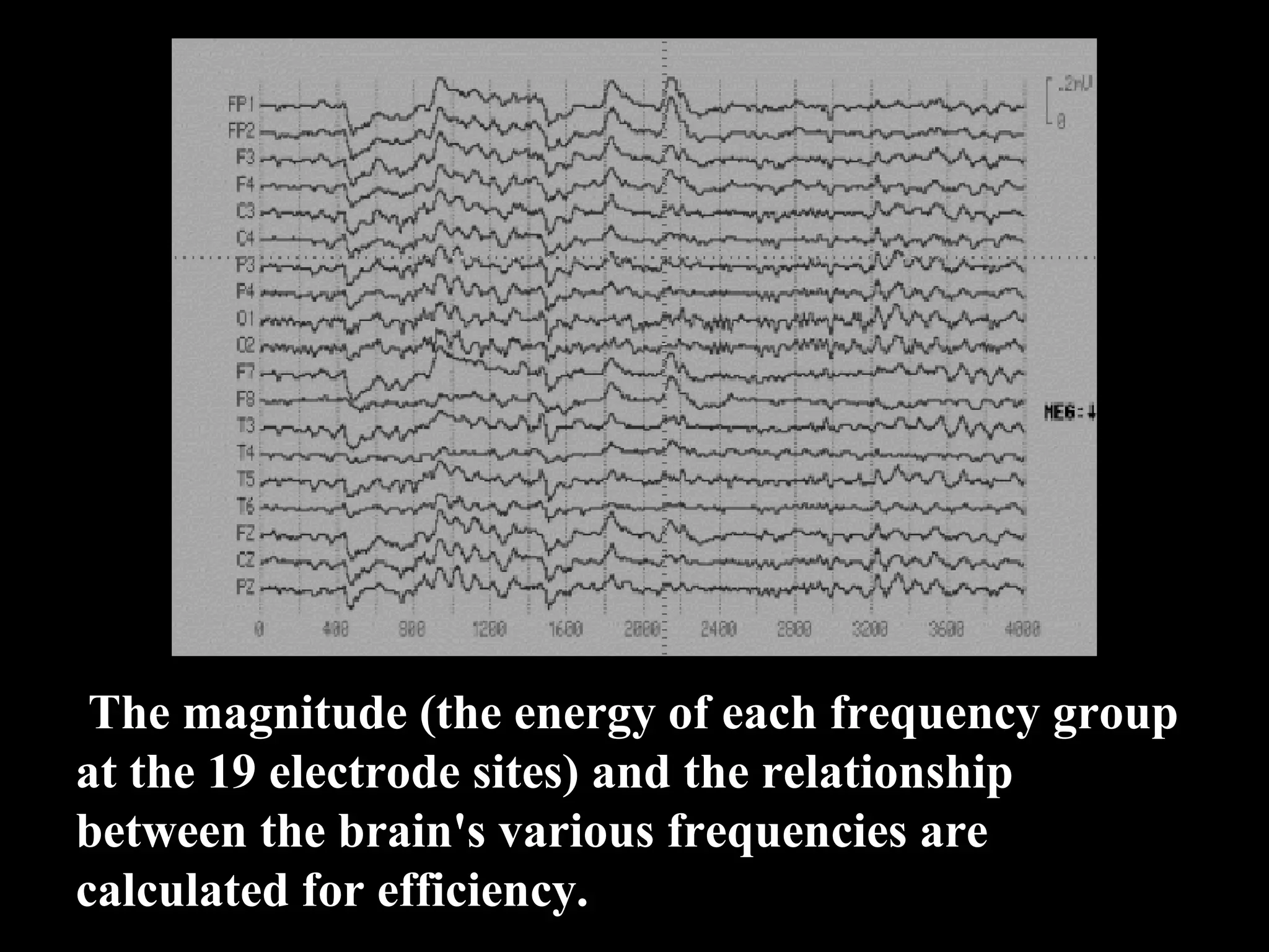 The magnitude (the energy of each frequency group at the 19 electrode sites) and the relationship between the brain's various frequencies are calculated for efficiency. 