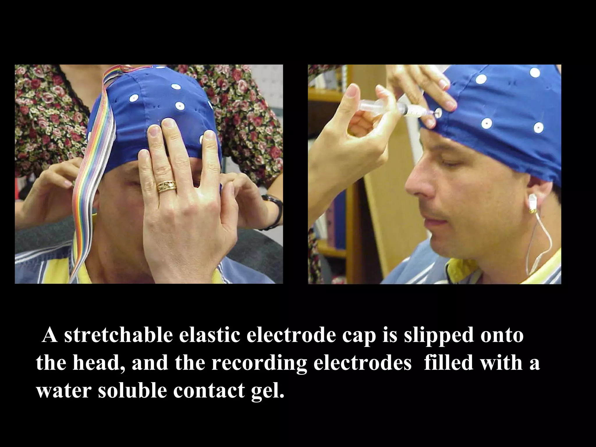  A stretchable elastic electrode cap is slipped onto  the head, and the recording electrodes  filled with a  water soluble contact gel.  