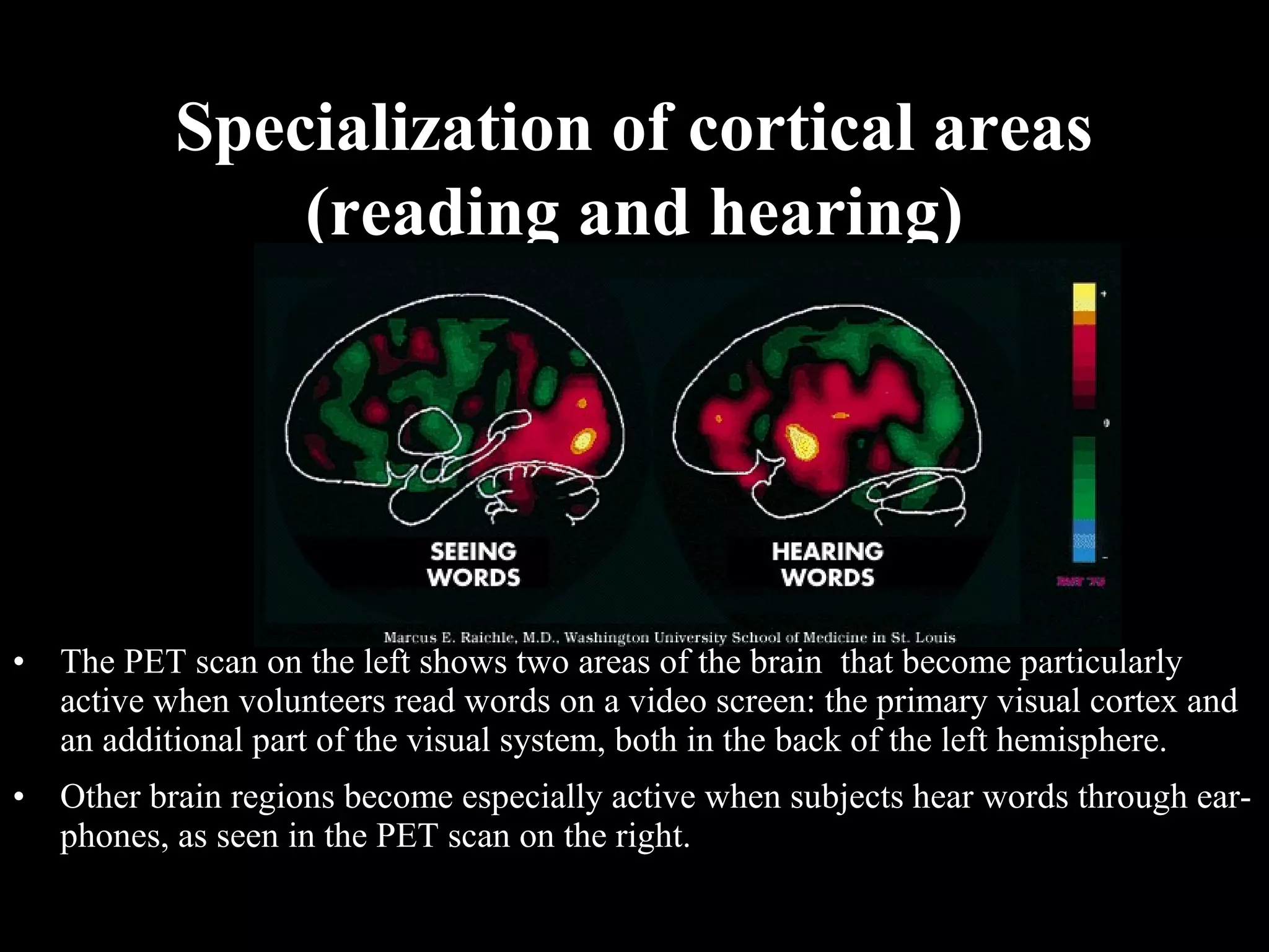 Specialization of cortical areas (reading and hearing) • The PET scan on the left shows two areas of the brain that become particularly active when volunteers read words on a video screen: the primary visual cortex and an additional part of the visual system, both in the back of the left hemisphere. • Other brain regions become especially active when subjects hear words through ear- phones, as seen in the PET scan on the right. 