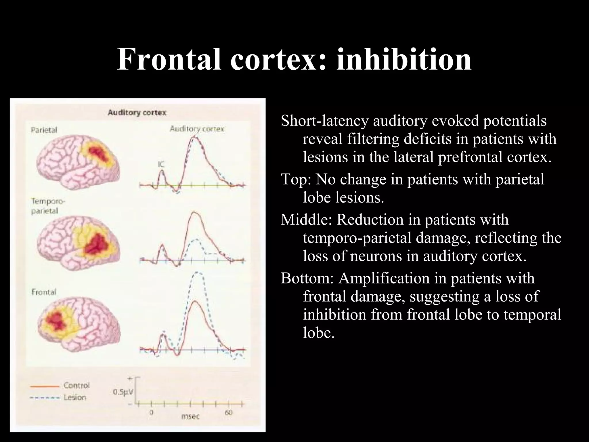 Frontal cortex: inhibition Short-latency auditory evoked potentials reveal filtering deficits in patients with lesions in the lateral prefrontal cortex. Top: No change in patients with parietal lobe lesions. Middle: Reduction in patients with temporo-parietal damage, reflecting the loss of neurons in auditory cortex. Bottom: Amplification in patients with frontal damage, suggesting a loss of inhibition from frontal lobe to temporal lobe. 