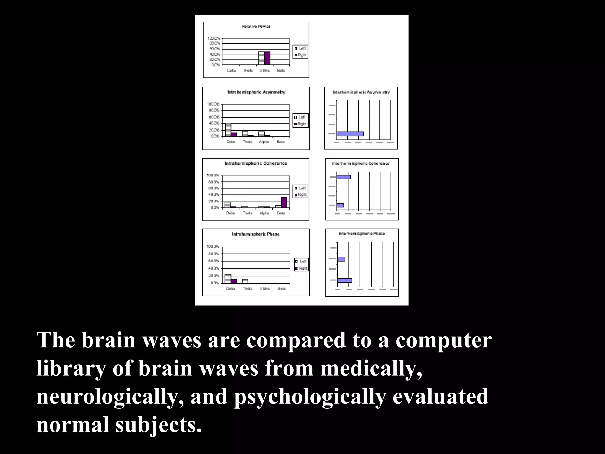 The brain waves are compared to a computer  library of brain waves from medically,  neurologically, and psychologically evaluated  normal subjects.  