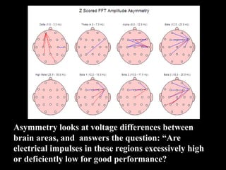 Asymmetry looks at voltage differences between 
brain areas, and  answers the question: “Are 
electrical impulses in these regions excessively high 
or deficiently low for good performance?
 