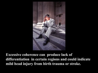 Excessive coherence can produce lack of
differentiation in certain regions and could indicate
mild head injury from birth trauma or stroke.
 