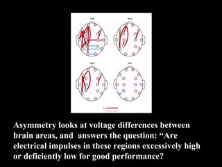 Asymmetry looks at voltage differences between
brain areas, and answers the question: “Are
electrical impulses in these regions excessively high
or deficiently low for good performance?
 