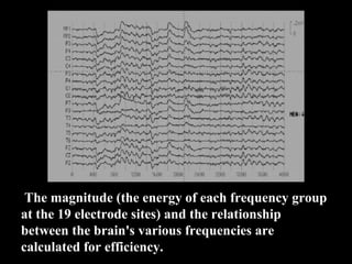 The magnitude (the energy of each frequency group
at the 19 electrode sites) and the relationship
between the brain's various frequencies are
calculated for efficiency.
 