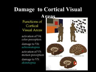 Damage to Cortical Visual
Areas
 