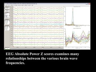 EEG Absolute Power Z scores examines many 
relationships between the various brain wave 
frequencies. 
 