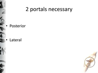 2 portals necessary
• Posterior
• Lateral
 
