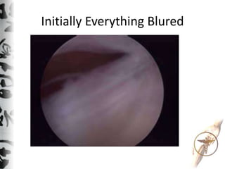 Initially Everything Blured
 