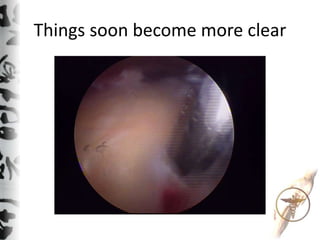 Things soon become more clear
 