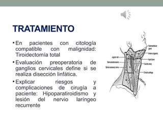 TRATAMIENTO
•En pacientes con citología
compatible con malignidad:
Tiroidectomía total
•Evaluación preoperatoria de
ganglios cervicales define si se
realiza disección linfática.
•Explicar riesgos y
complicaciones de cirugía a
paciente: Hipoparatiroidismo y
lesión del nervio laríngeo
recurrente
 