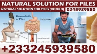 Piles Natural Remedy ,
