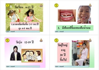 ครูวิภา แจมฤทธิ์
# 6-12 )
1. # , >7 2-3 กก./ )
4 4-5 3 ./ )
ครูวิภา แจมฤทธิ์ ครูวิภา แจมฤทธิ์
2. BC %8 >7 % BC 70
ครูวิภา แจมฤทธิ์
ครูวิภา แจมฤทธิ์
# 12-19 )
ครูวิภา แจมฤทธิ์
# <8 :
20 )
>7 9
ครูวิภา แจมฤทธิ์
 