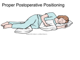 Proper Postoperative Positioning
 