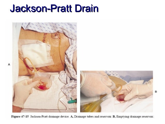 Jackson Pratt Vs Penrose Drain