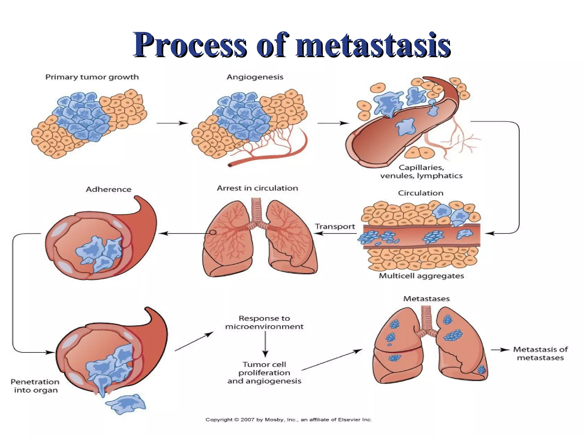 Process of metastasis
 
