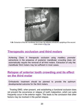 Clinical Success In Impacted Third Molar Extraction Jeanmarie Korbendau ...