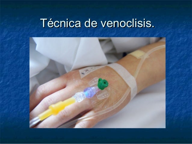 55687889 tecnica-de-venoclisis