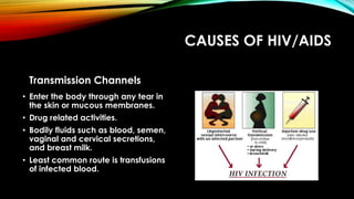 CAUSES OF HIV/AIDS
Transmission Channels
• Enter the body through any tear in
the skin or mucous membranes.
• Drug related activities.
• Bodily fluids such as blood, semen,
vaginal and cervical secretions,
and breast milk.
• Least common route is transfusions
of infected blood.
 