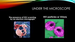 UNDER THE MICROSCOPE
The presence of HIV scanning
by an electron micrograph
HIV particles or Virions
 