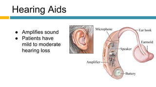 Hearing Aids
● Amplifies sound
● Patients have
mild to moderate
hearing loss
 