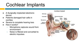 Cochlear Implants
● A Surgically implanted electronic
device
● Patients damaged hair cells in
cochlea
● Severe to complete hearing loss
● How it works?
○ Microphone captures sound from
environment
○ Noise is filtered and converted to
electric impulses
 