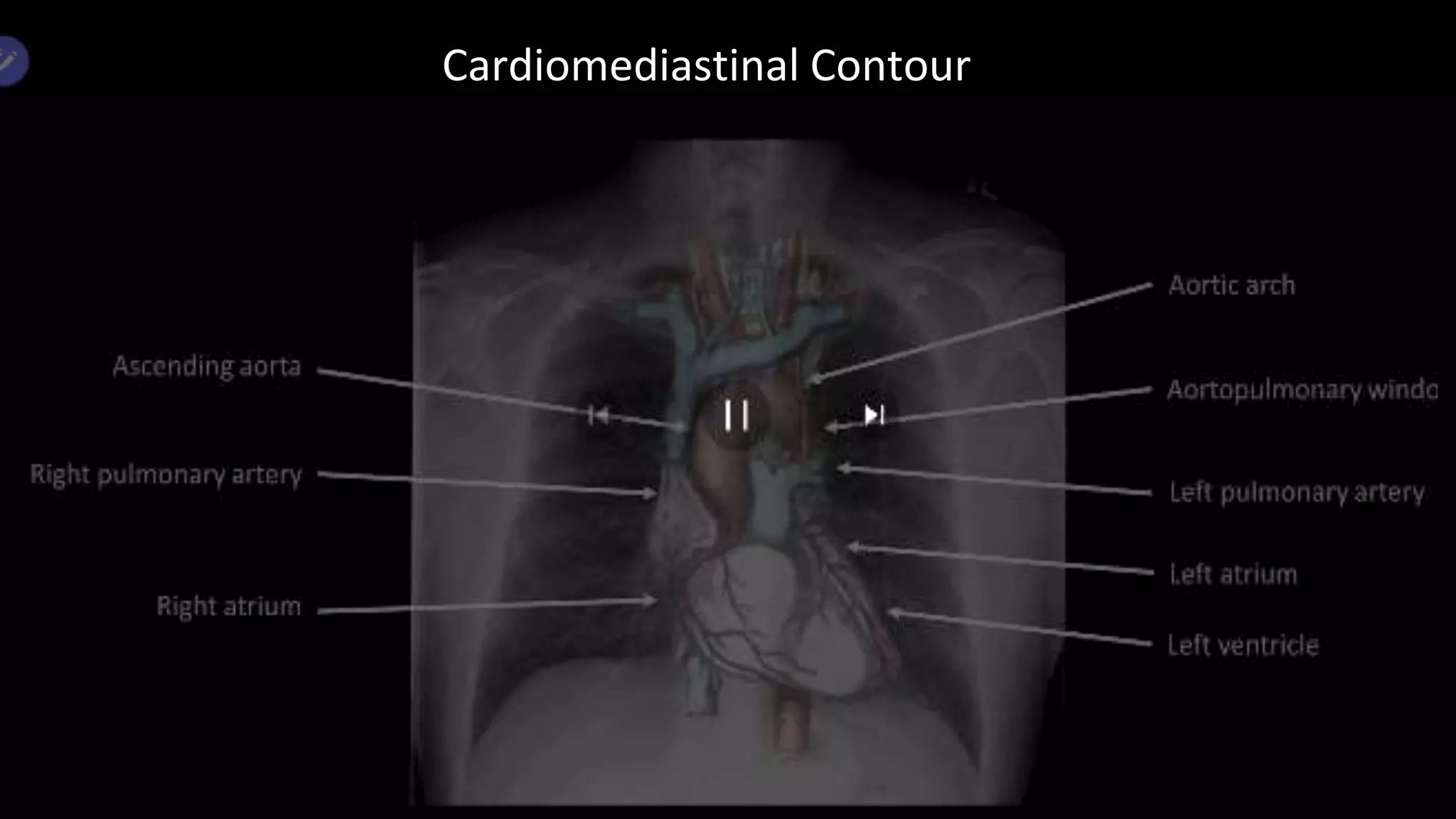 55-kr-shashikant-raj-cvs-x-ray-1-pptx