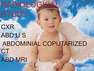 RADIOLOGICAL
STUDY
CXR
ABD U S
ABDOMINIAL COPUTARIZED
CT
ABD MRI
 