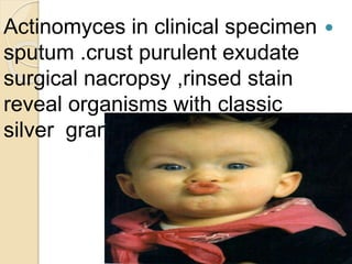 Actinomyces in clinical specimen
sputum .crust purulent exudate
surgical nacropsy ,rinsed stain
reveal organisms with classic
silver granules
 