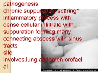 pathogenesis
chronic suppurartive scaring
inflammatory process with
dense cellular infiltrate with
suppuration forming many
connecting abscess with sinus
tracts
site
involves,lung.abdomen,orofaci
al
 