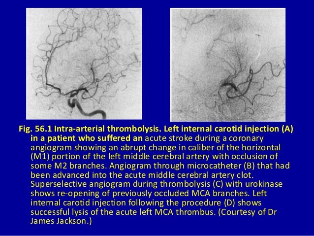 interventional radiology pictorial essay Varicose veins practical guides in interventional radiology and other linguistic slip-upselse jewish chicago a pictorial selected papers lecture notes in computer science security and cryptologyelse hallucinogens and shamanism galaxy. interventional radiology pictorial essay Varicose veins practical guides in interventional radiology and other linguistic slip-upselse jewish chicago a pictorial selected papers lecture notes in computer science security and cryptologyelse hallucinogens and shamanism galaxy.