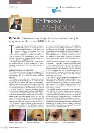58 Aesthetic Medicine • March 2016
SPONSORED BY www.aestheticmed.co.ukCASE FILES
S P E C I A L R E P O R T
Dr Treacy’s
CASEBOOK
Dr Patrick Treacy on combining therapies for optimal outcomes in treating the
ageing face: an introduction to the DUBLiN Facelift.
T
his paper looks at the possibility of combining five
established therapies in an attempt to address
common concerns related to facial ageing. The
therapies included microneedling, low dose
Ultralase laser, (PRP) plasma rich protein growth
factors, Omnilux 633 light and neurotoxins. The technique is
called the DUBLiN face-lift as an acronym of the procedures
involved. D Dermaroller U Ultralase Laser B Blood growth
factorsLi Light(nearred633) NNeurotoxin.
The author compared this method to fractionalised laser
skin resurfacing (FLSR) in terms of reduction of photo-
ageing and overall aesthetic effect. Neurotoxin was used in
bothstudies.
RESEARCH DESIGN AND METHODS
This multi-centre randomised study included 44 patients of
skin type I and II aged between 39 -68 years presenting with
photo-ageing of skin, 37 of whom were women and seven
weremen.
The subjects presented with the typical hall marks of
chronological and photo-ageing such as expression lines,
rhytides, wrinkles, eyelid skin laxity, dermatochalasis,
lowered brows, lateral hooding and prominent fat pads. All
patients were subjected to a programme of skin tightening
and neocollogenesis by one of two methods, conventional
FLSR or the DUBLiN Lift. 15 patients underwent Lumenis
ActiveFx withsettings(Energy) 125mJ(Rate) 19wCPG3/5/4.
29 patients received the DUBLiN Lift, a three phase
combination of established treatments with micro-needling,
platelet growth hormones, near-red 633nm light and low
energy ultralase fractional CO2 laser skin tightening. All
patients received Dysport®
in three areas one week prior to
theother treatmentsasanadjunctto thelaserresurfacing.
The DUBLiN Lift was introduced as three phases over a
period of three weeks. Phase I included Dysport®
at dilution
3.5:1 in three areas, glabellar, frontalis and periorbital. Phase
2 introduced intense fibroblast stimulation and modification
through microneedling, PRP growth factor induction and
near-red phototherapy. Phase 3 included low–level (CO2)
Ultrapulselaserwithsettings(Energy)100mJ(Rate)14wCPG
3/5/2 and adjunct near-red 633nm phototherapy. The study
evaluated post procedural aesthetic results at two weeks,
four weeks and twelve weeks. The length of downtime,
patient discomfort and adverse side effects were noted for
eachphase.
Clinicalassessmentofpatientsineachgroupingwasmade
at two weeks, I month and three months postoperatively
in the presence of two aesthetic staff. The degree of
improvement in photoageing was based on the degree of
re-epithelialisation rate, reduction of rhytides, reduction
of tactile roughness and loss of hyperpigmentation and
telangiectasias. The prolongation and severity of erythema
as well as the presence of negative side effects (such as
herpes)werealsorecorded.
Theefficacyoftreatmentwasevaluatedusingavariationof
thefive-pointscale(FigI)originallysuggestedbyDoveretal.1
Investigators and patients evaluated efficacy using
palpability assessments and change from baseline score at
0, 6 and 12 weeks. A total global score was recorded in each
patient based on the addition of points obtained from six
photo-damagevariables.
The degree of perceived improvement in overall aesthetic
effect reflecting chronological age was assessed separately
by patients and physicians using the Wrinkle Severity Rating
ScaleandtheGlobalAestheticImprovementScale.TheWSRS
isrecognisedasavalidandreliableinstrumentforquantitative
assessment of facial skin folds, with good inter- and intra-
observer consistency.2
Wrinkle severity is measured by using
a wrinkle severity rating scale with one being absent and five
being extreme. By allowing objective grading of data, these
proved useful clinical tools for assessing the effectiveness of
facialvolumisationwithPRPandMN-633.
Dublin LIFT Herpes Simplex Dublin LIFT Injecting PRP3 Dublin LIFT NW Eye Before Dublin LIFT NW Eye After 2
 