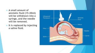  A small amount of
amniotic fluid (15-20ml)
will be withdrawn into a
syringe, and the needle
will be removed.
 It is replaced by injecting
a saline fluid.
 