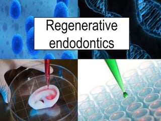 Regenerative
endodontics
1
 