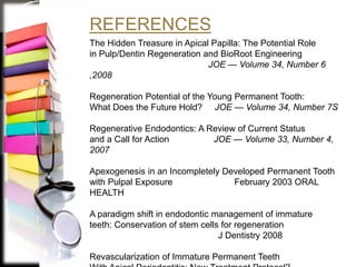 REFERENCES
The Hidden Treasure in Apical Papilla: The Potential Role
in Pulp/Dentin Regeneration and BioRoot Engineering
JOE — Volume 34, Number 6
,2008
Regeneration Potential of the Young Permanent Tooth:
What Does the Future Hold? JOE — Volume 34, Number 7S
Regenerative Endodontics: A Review of Current Status
and a Call for Action JOE — Volume 33, Number 4,
2007
Apexogenesis in an Incompletely Developed Permanent Tooth
with Pulpal Exposure February 2003 ORAL
HEALTH
A paradigm shift in endodontic management of immature
teeth: Conservation of stem cells for regeneration
J Dentistry 2008
Revascularization of Immature Permanent Teeth
 