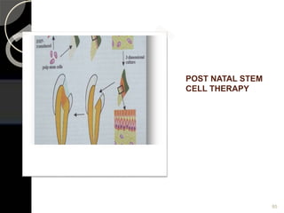 POST NATAL STEM
CELL THERAPY
85
 