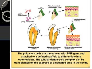 The pulp stem cells are transduced with BMP gene and
attached to a defined scaffold to differentiate into
odontoblasts. The tubular dentin-pulp complex can be
transplanted on the exposed or amputated pulp in the cavity.
92
 