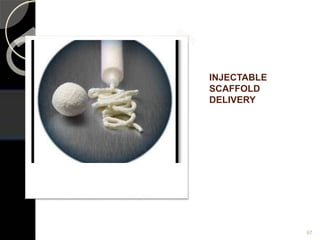 INJECTABLE
SCAFFOLD
DELIVERY
97
 