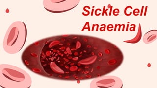 Sickle Cell
Anaemia
 