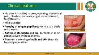18/01/2023 AIIMS Rajkot 21
Clinical features
Malaise, irritability, nausea, vomiting, abdominal
pain, diarrhea, anorexia, cognitive impairment,
forgetfulness.
Mild jaundice
Atrophy of tongue papillae gives rise to a beefy
red tongue.
Aphthous stomatitis and oral soreness in some
patients even without anemia.
Transient darkening of nails and skin (knuckle
hyperpigmentation)
Beefy red tongue
Aphthous ulcer
 